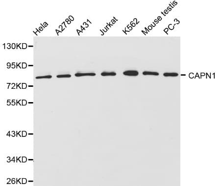 IHC-plus™ CAPN1 / Calpain 1 Antibody