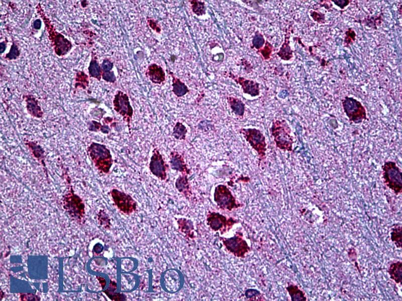 IHC-plus™ Monoclonal Mouse anti-Human BAF60B / SMARCD2 Antibody (clone 2F7, IHC, IF, WB)