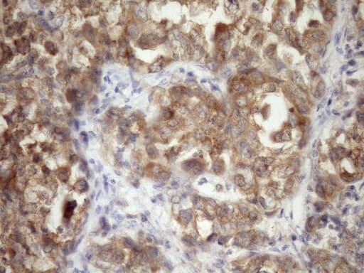 TARBP2 / TRBP2 Antibody (clone OTI7C1)