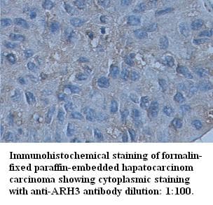 Polyclonal Rabbit anti-Human ADPRHL2 Antibody (C-Terminus, IHC)