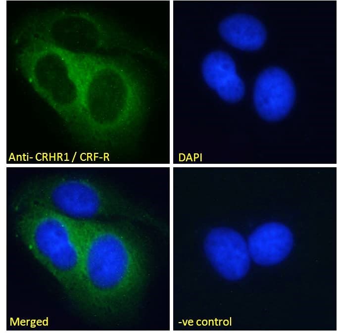 IHC-plus™ Polyclonal Goat anti-Human CRFR1 / CRHR1 Antibody (aa250-263, IHC, IF, WB)