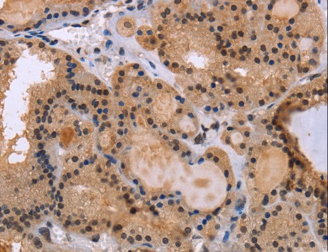 KIF25 Antibody