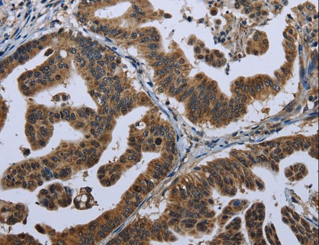 Polyclonal Rabbit anti-Human GPAM Antibody (IHC)