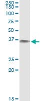 Monoclonal Mouse anti-Human BLVRA Antibody (clone S2, WB)