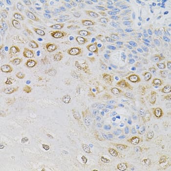 GNA13 Antibody