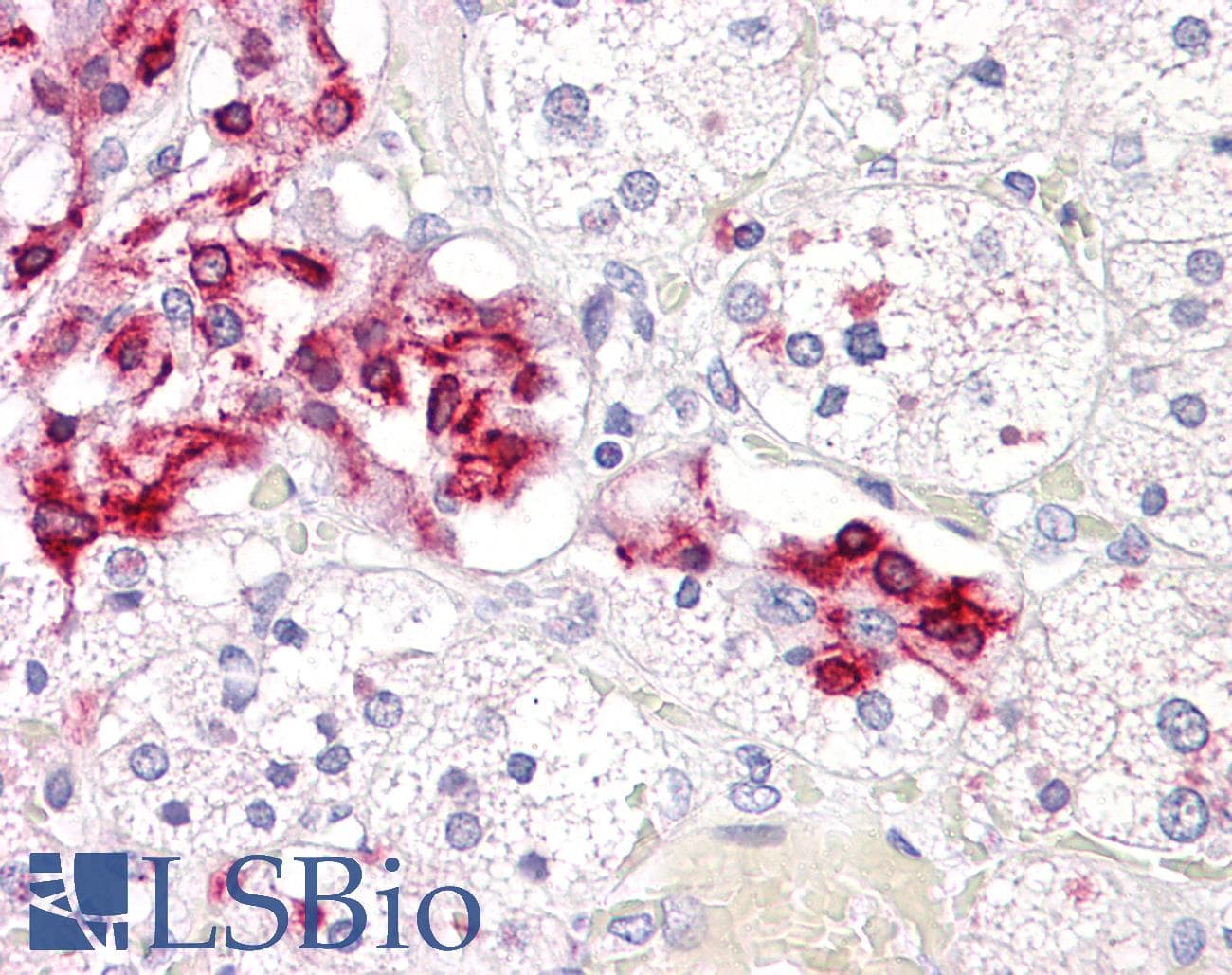 IHC-plus™ CASP2 / Caspase 2 Antibody (aa123-172)