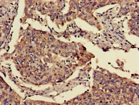 Polyclonal Rabbit anti-Human FOXN1 Antibody (IHC, WB)