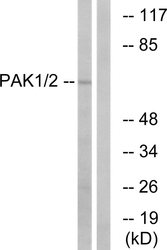 IHC-plus™ PAK1 Antibody (aa165-214)
