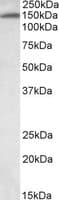 IHC-plus™ ITIH4 Antibody (aa890-903)