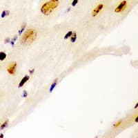 CCNE1 / Cyclin E1 Antibody