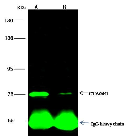 CTAGE1 / CTAGE Antibody (Preservative Free)