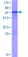 Human SIRT5 / Sirtuin 5 Protein (Recombinant GST)