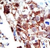 Polyclonal Rabbit anti-Human PIAS2 / PIASX Antibody (aa1-30, IHC, WB)