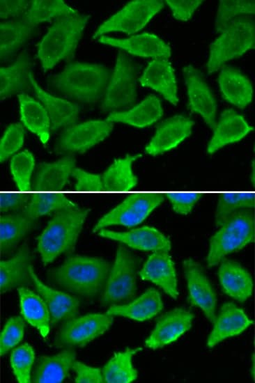 Polyclonal Rabbit anti-Human IFNA1 / Interferon Alpha 1 Antibody (IF, WB)