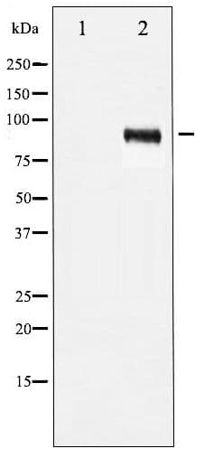 IGF1R / IGF1 Receptor Antibody (phospho-Tyr1161)