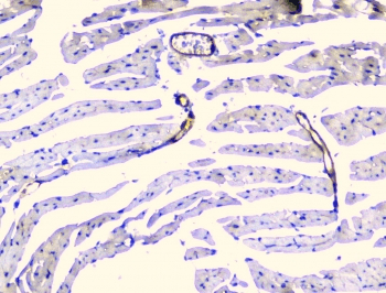 TEK / TIE2 Antibody