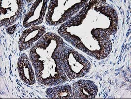 Thymidylate Kinase Antibody (clone OTI1G8)
