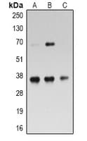 Polyclonal Rabbit anti-Human RPL5 / Ribosomal Protein L5 Antibody (Internal, IHC, WB)