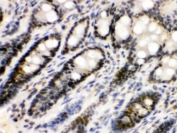 EME1 Antibody