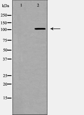 Polyclonal Rabbit anti-Human NOTCH2 Antibody (Cleaved Asp1733, IHC, IF, WB)