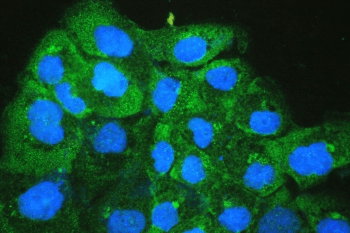 Polyclonal Rabbit anti-Human CD47 Antibody (IHC, IF, WB)
