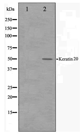 Polyclonal Rabbit anti-Human KRT20 / CK20 / Cytokeratin 20 Antibody (IHC, WB)