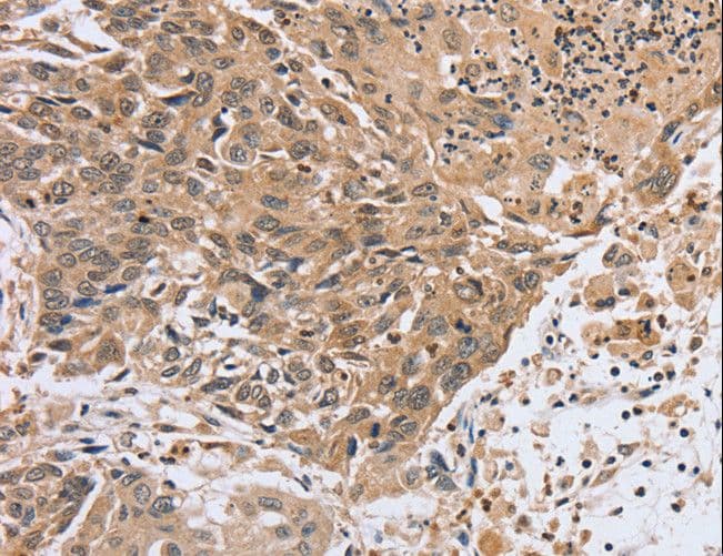 PTPMEG / PTPN4 Antibody