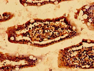 Polyclonal Rabbit anti-Human HSCB Antibody (IHC, WB)