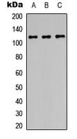 Polyclonal Rabbit anti-Human PPP1R13B Antibody (Internal, WB)