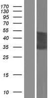 CT47A5 Protein (Over-Expression Lysate Myc-DDK (Flag))