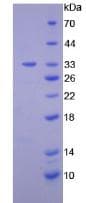 Human DGKE / DGK Epsilon Protein (Recombinant His, N-Terminal)