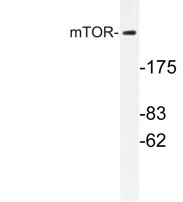 IHC-plus™ Polyclonal Rabbit anti-Human MTOR Antibody (Ser2442, IHC, IF, WB)