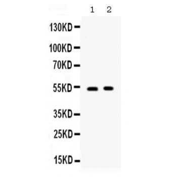 Polyclonal Rabbit anti-Human TNFRSF4 / CD134 / OX40 Antibody (aa232-254, IHC, WB)
