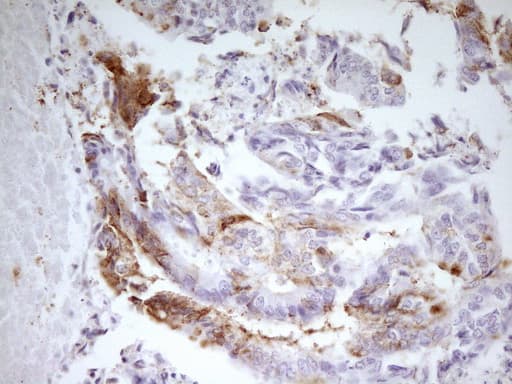 Monoclonal Mouse anti-Human MED15 / ARC105 Antibody (clone OTI1H5, Carrier-free, aa393-679, IHC, WB)