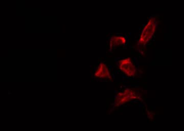 PNPLA2 / ATGL Antibody