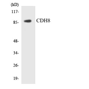 CDH8 / Cadherin 8 Antibody (aa470-519)
