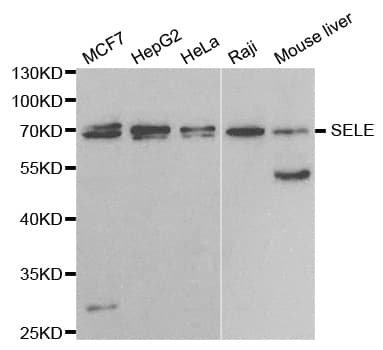 SELE / CD62E / E-selectin Antibody