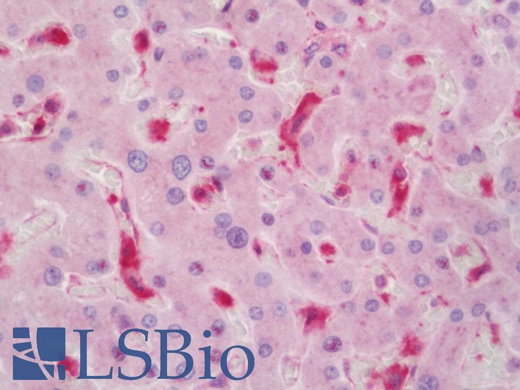 IHC-plus™ Polyclonal Rabbit anti-Human ADCK4 Antibody (aa6-55, IHC, WB)