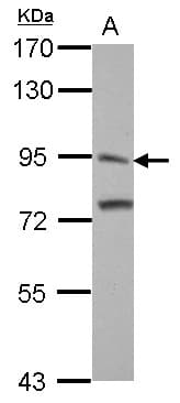ITIH3 Antibody (aa119-383)