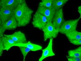 KRT8 / CK8 / Cytokeratin 8 Antibody (clone OTI1B12)