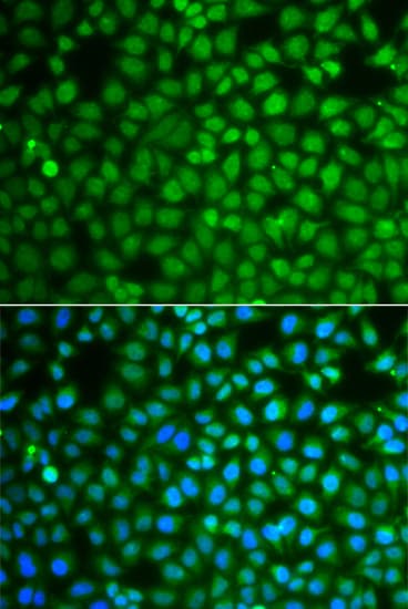 ZNF346 Antibody