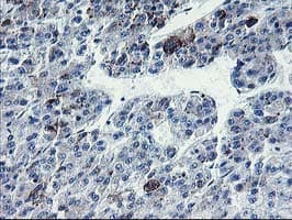 Nectin-1 / PVRL1 Antibody (clone OTI1B6)