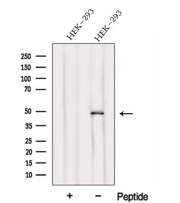 FBLIM1 / Migfilin Antibody