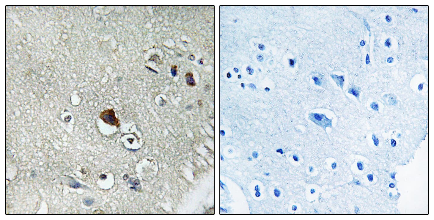 DVL3 / Dishevelled 3 Antibody (aa326-375)