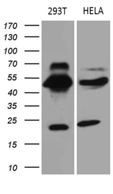 Monoclonal Mouse anti-Human TEKT2 Antibody (clone OTI1E6, aa1-244, WB)