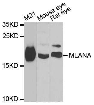 Polyclonal Rabbit anti-Human MLANA / Melan-A Antibody (IHC, IF, WB)