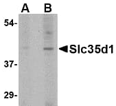 IHC-plus™ Polyclonal Rabbit anti-Human SLC35D1 Antibody (IHC, WB)