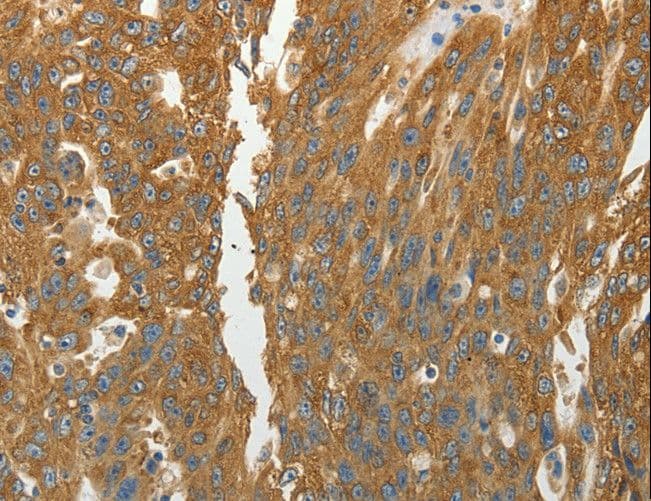 RPLP0 Antibody