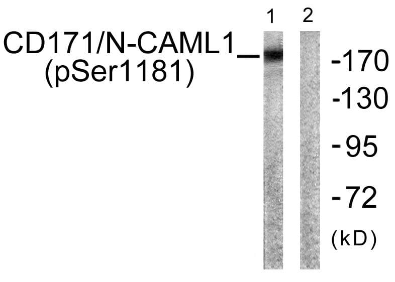 Polyclonal Rabbit anti-Human L1CAM Antibody (phospho-Ser1181, WB)