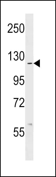 ABL1 / c-ABL Antibody (aa851-881)
